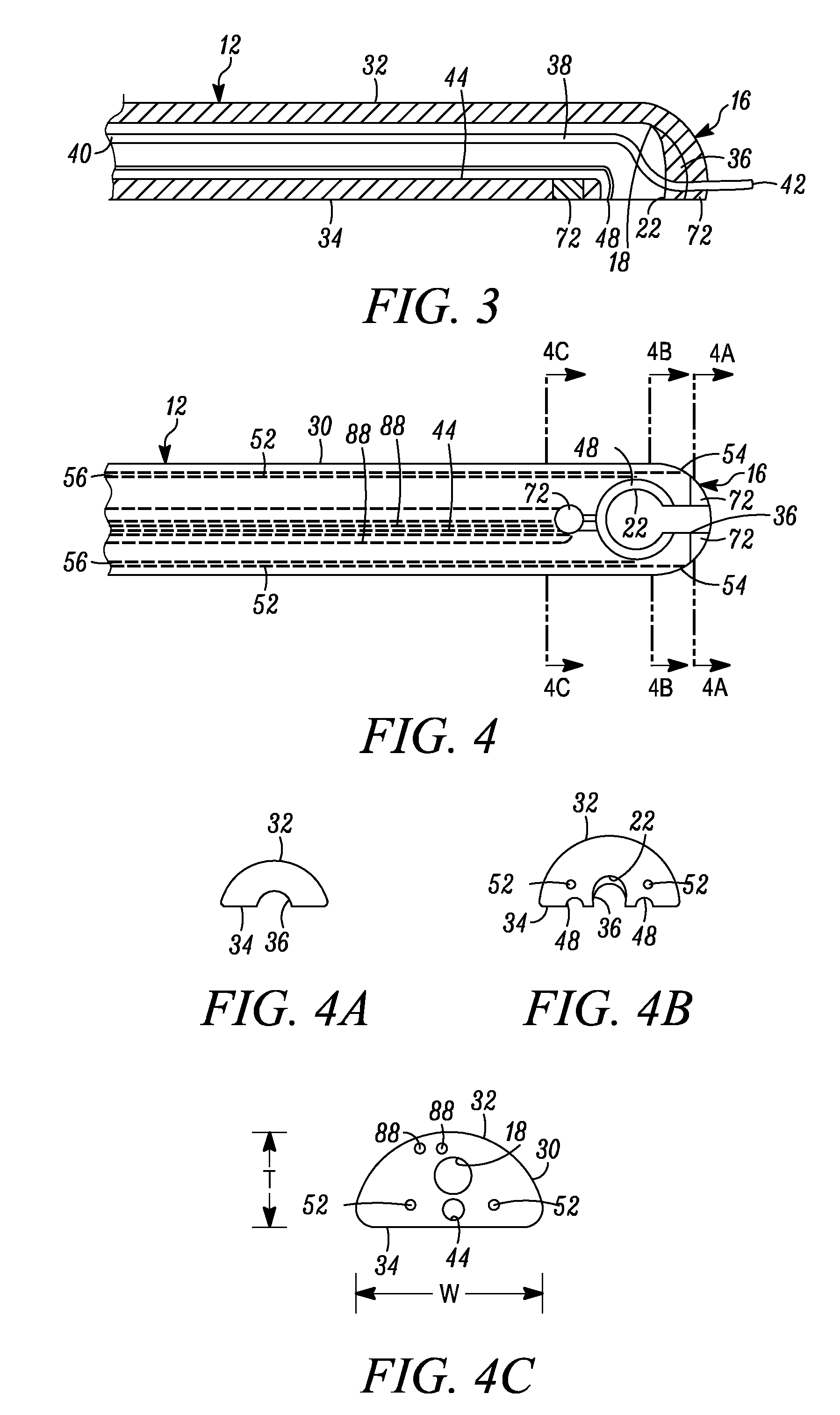 Methods and apparatus for lead placement on a surface of the heart