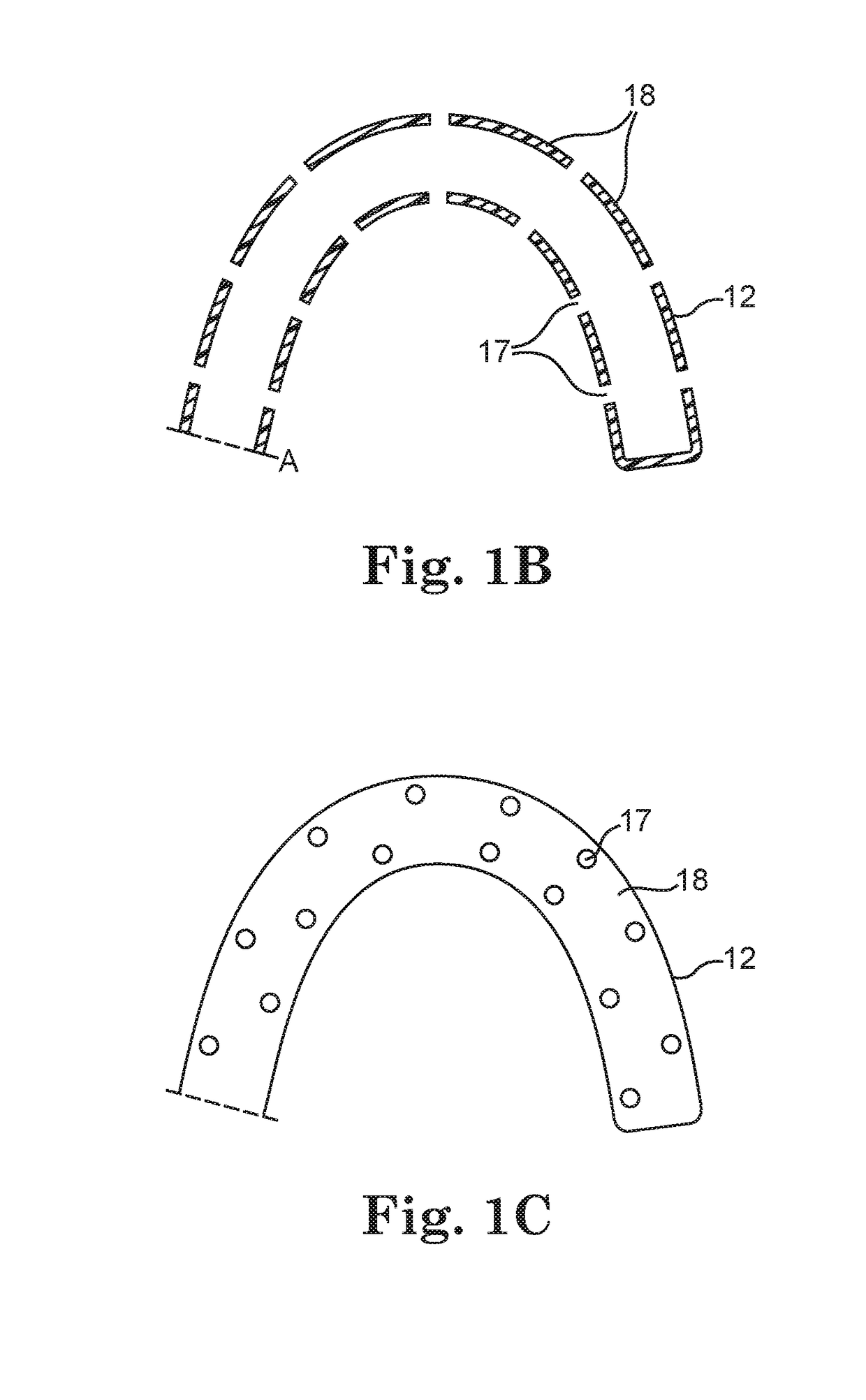 Cerebrospinal fluid shunt having long term Anti-occlusion agent delivery