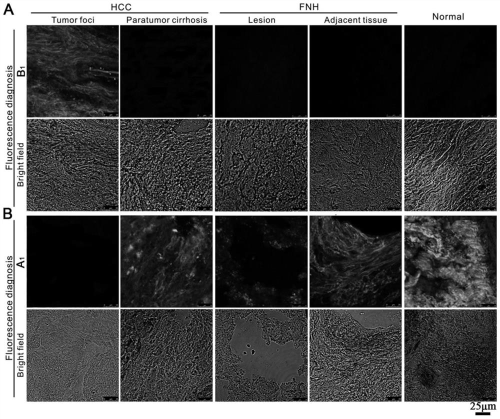 Fluorescent compound and its preparation method, and its application in cross-validation localization of liver tumor lesion tissue