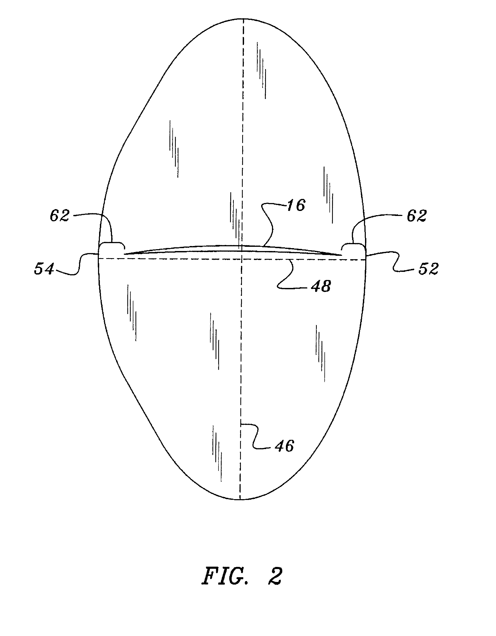 Bicuspid vascular valve and methods for making and implanting same