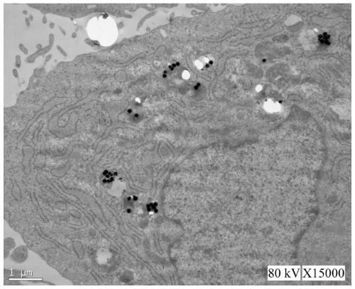 Ferroferric oxide superparamagnetic nanoparticle stimulating stem cell for exosome osteogenesis
