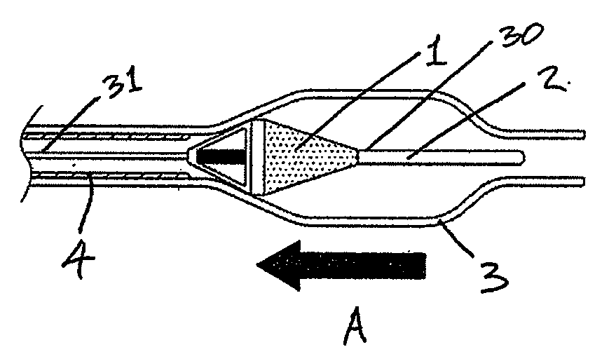 Method for filtering embolic material