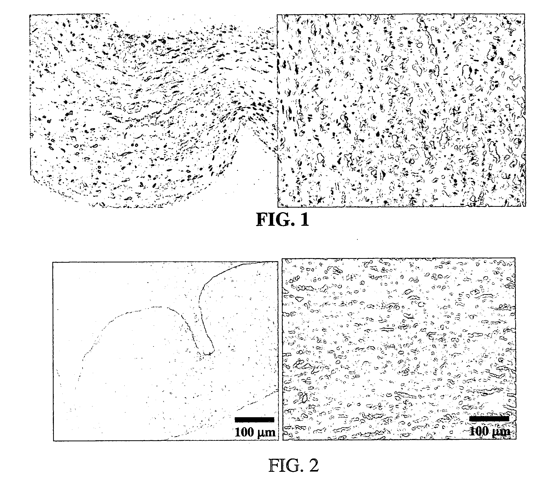 Processes for removing cells and cell debris from tissue and tissue constructs used in transplantation and tissue reconstruction