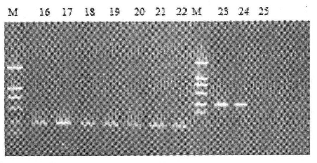 Use method of DGGE (Denaturing Gradient Gel Electrophoresis) technology in detecting phytoplankton structure