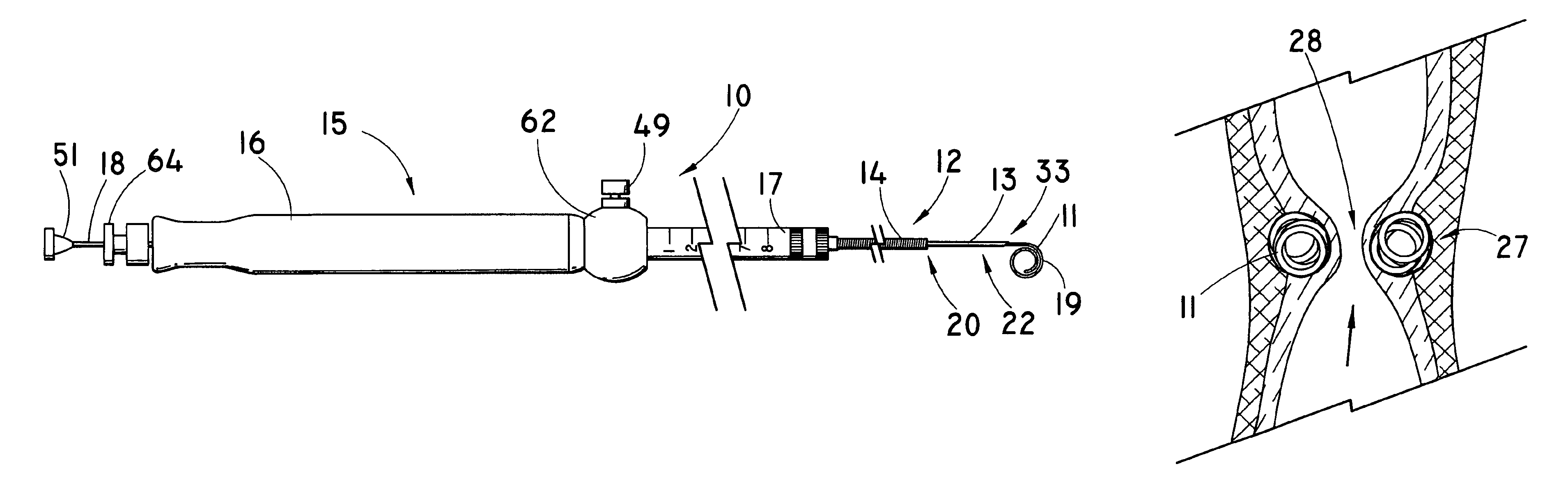 Method and apparatus for augmentation of a sphincter