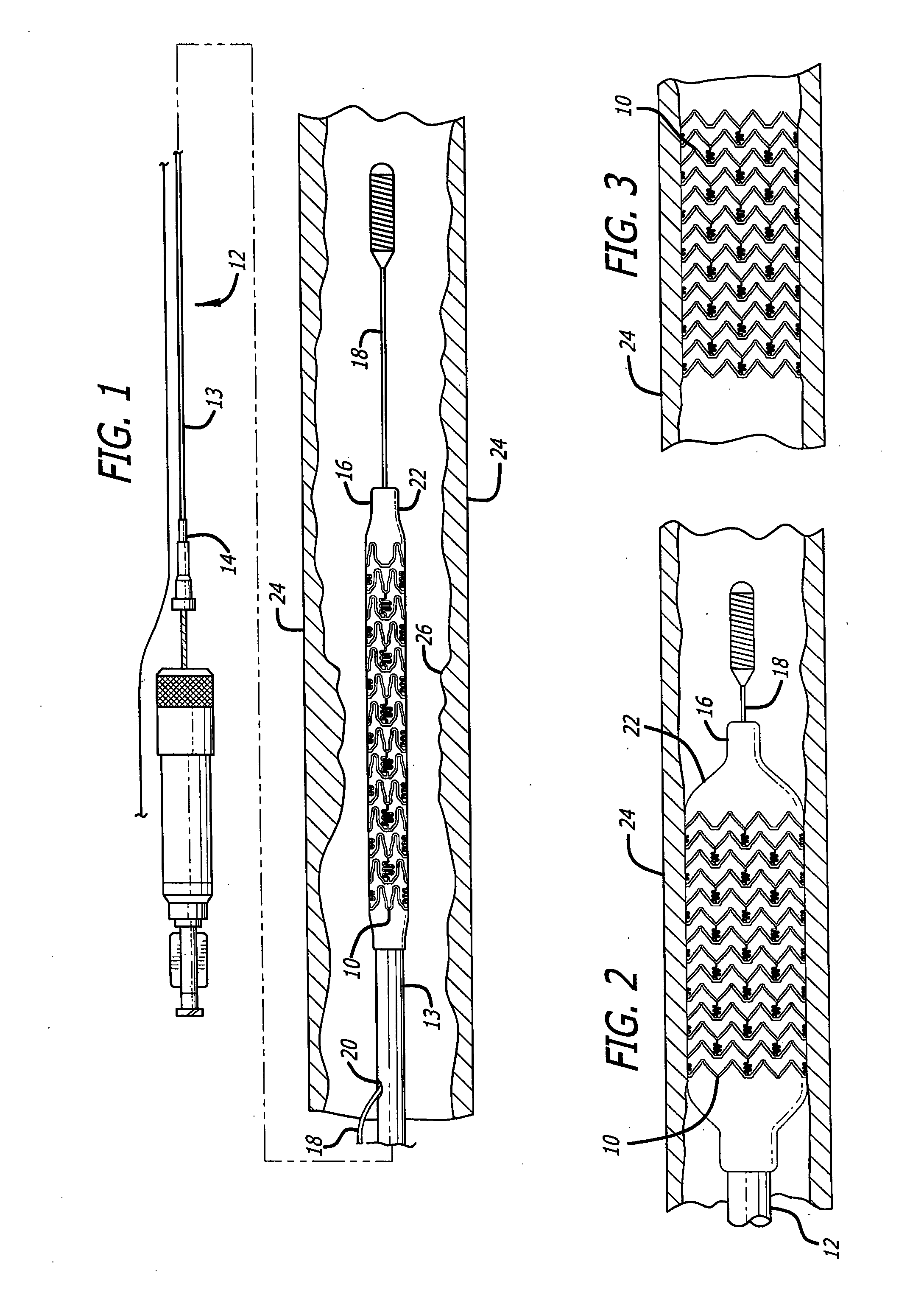 Apparatus and method for formation of foil-shaped stent struts