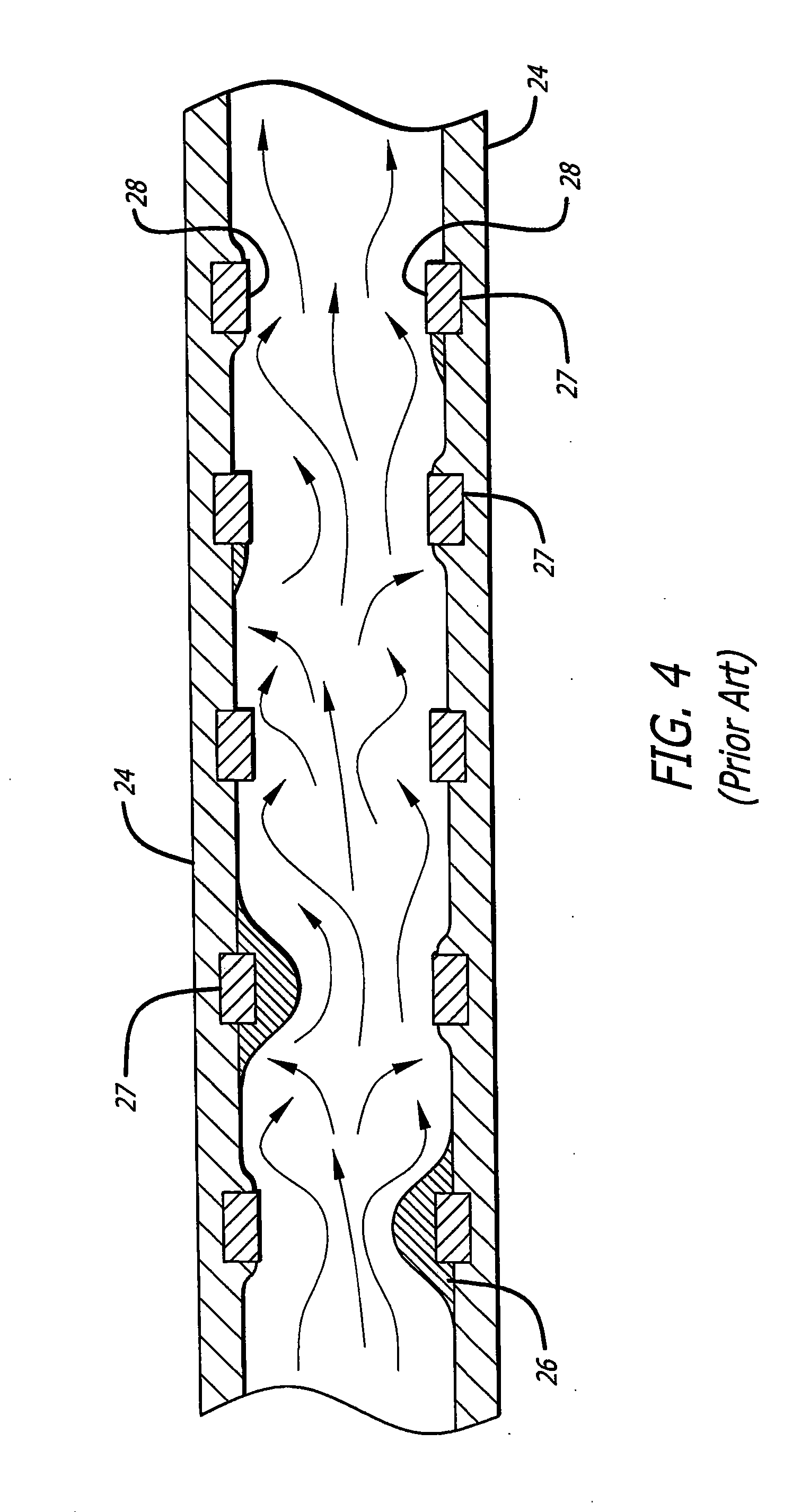 Apparatus and method for formation of foil-shaped stent struts