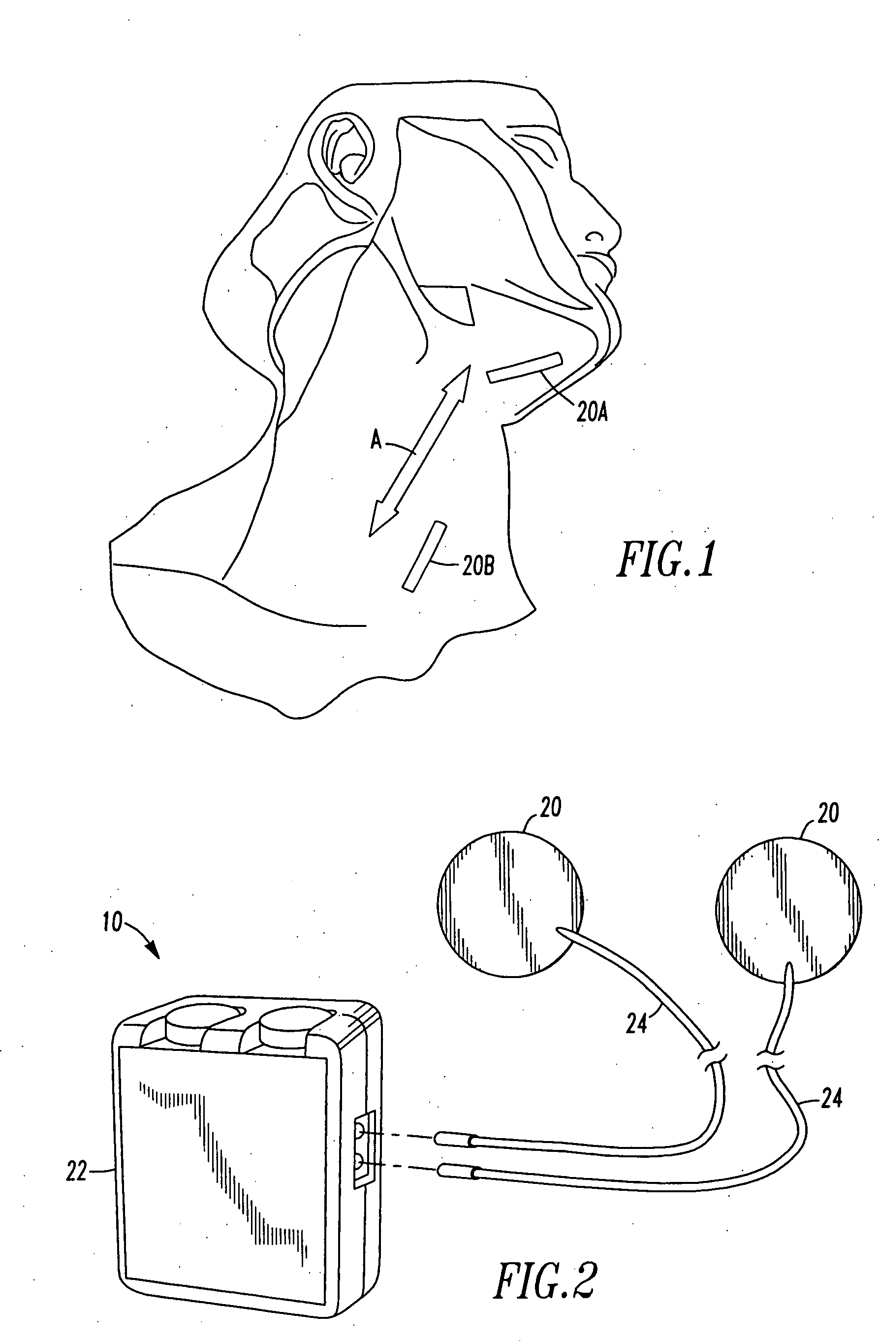 Method and device for the electrical treatment of sleep apnea and snoring
