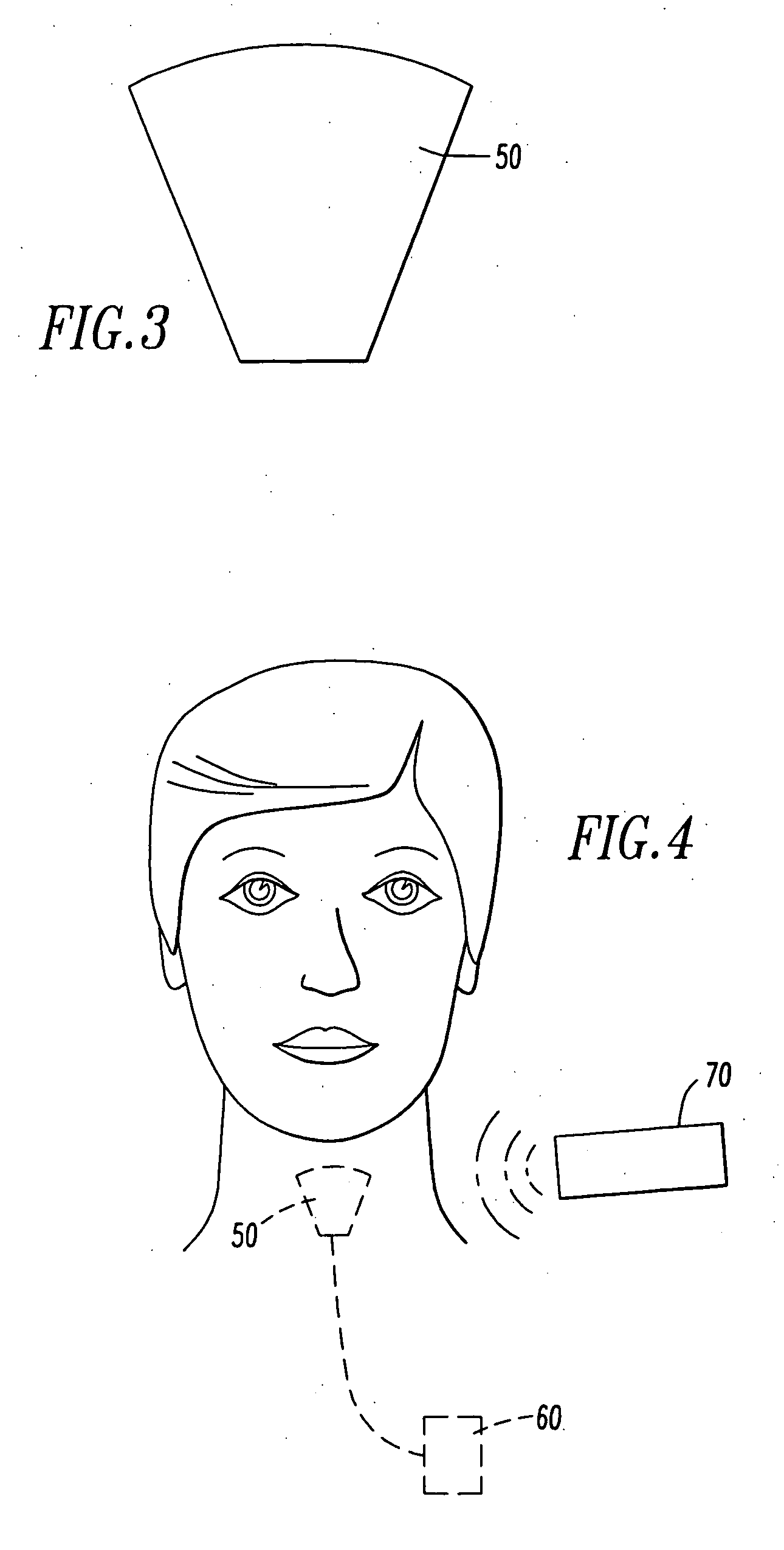 Method and device for the electrical treatment of sleep apnea and snoring