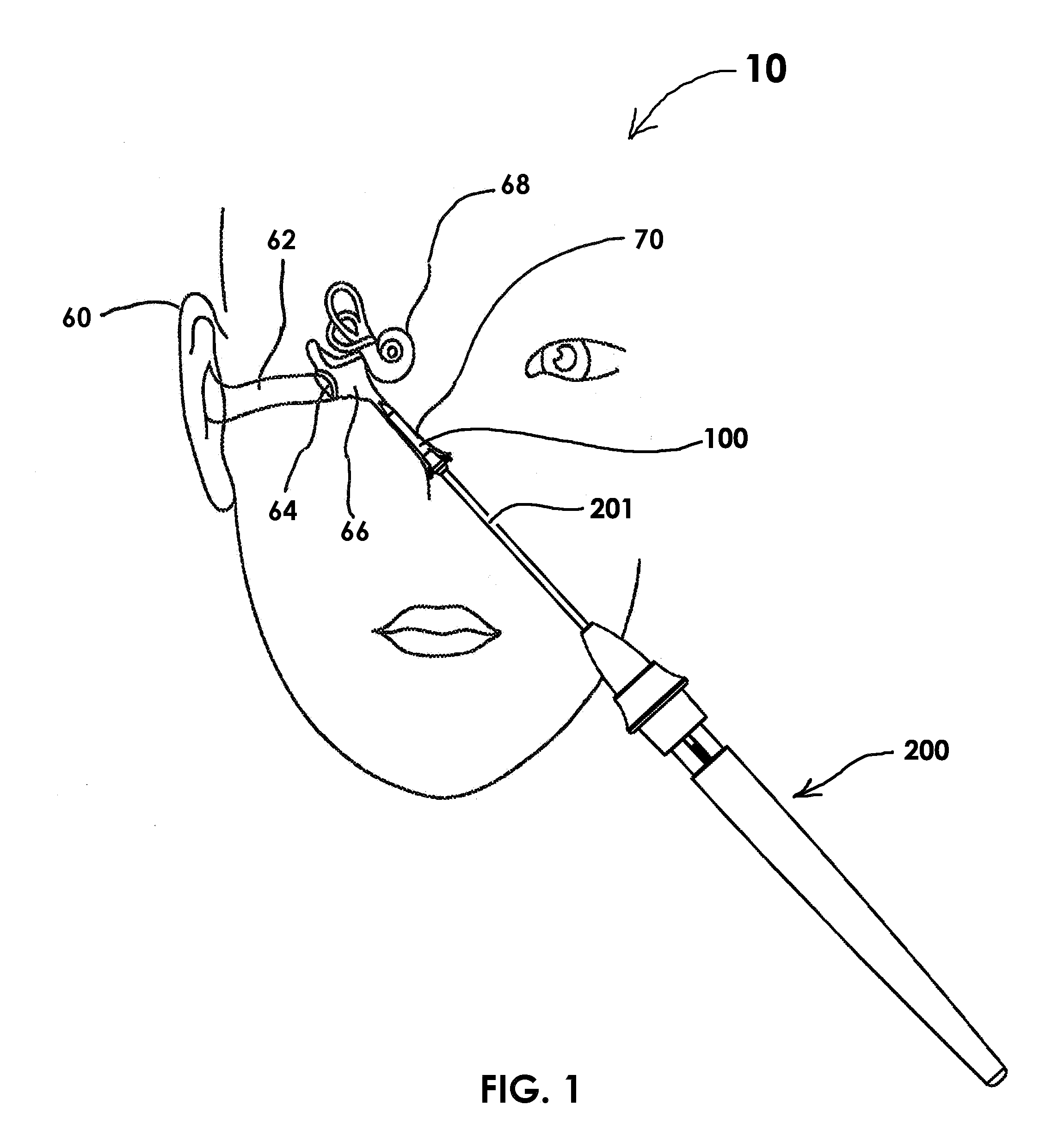 Devices and methods for Dilating a Eustachian Tube