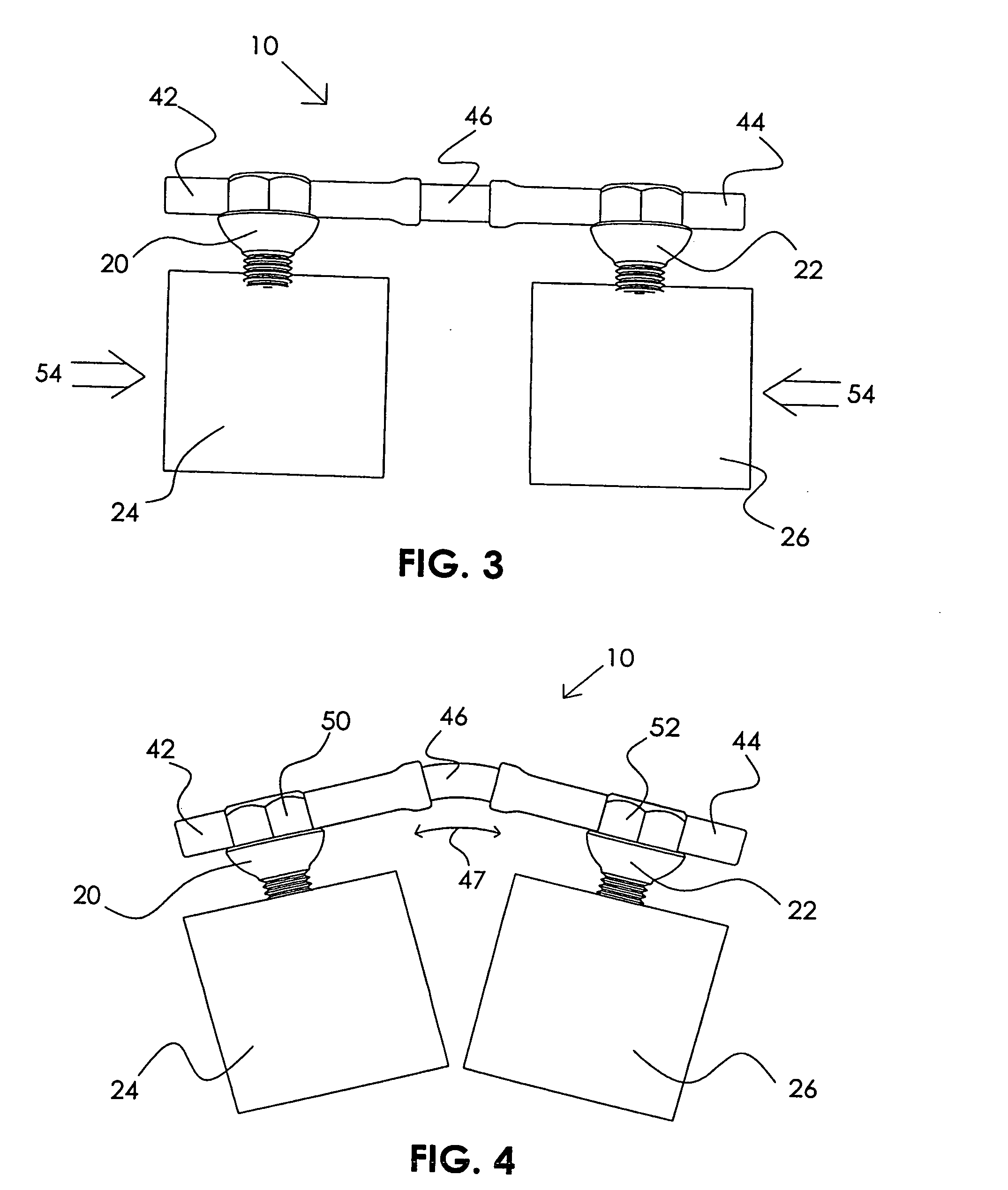 Mobile spine stabilization device