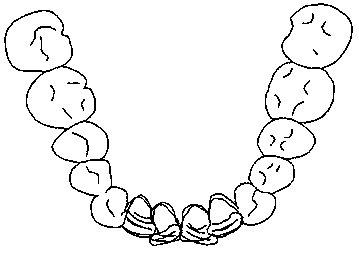 Digitalized making method of dental orthodontic appliance and fixed appliance