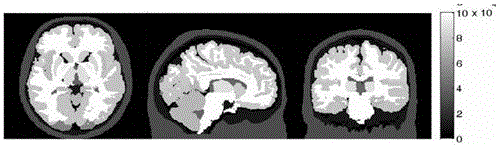 Maximum a posteriori reconstruction method for pet images based on joint prior model of anatomical function