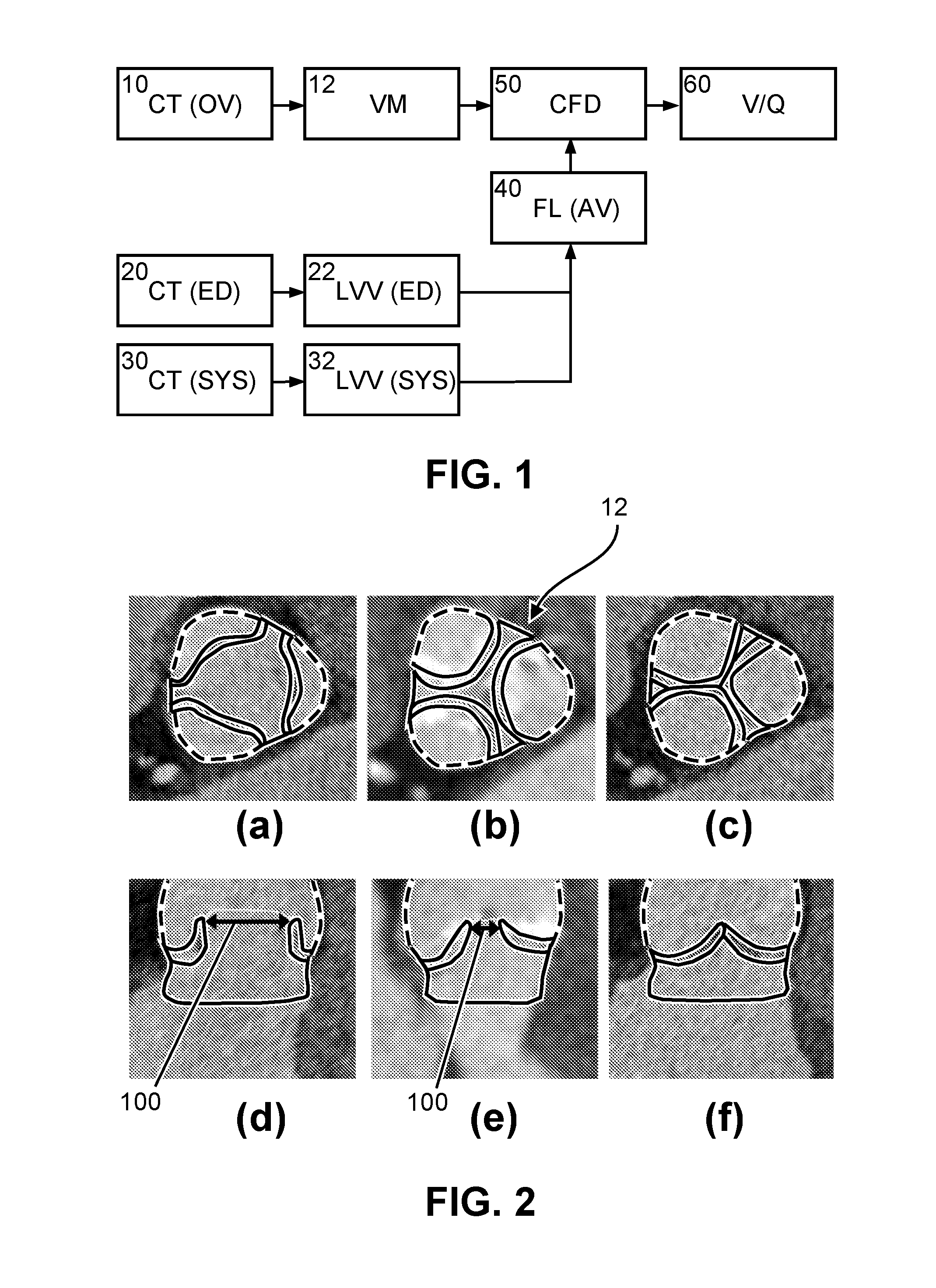 Method and apparatus for simulating blood flow under patient-specific boundary conditions derived from an estimated cardiac ejection output