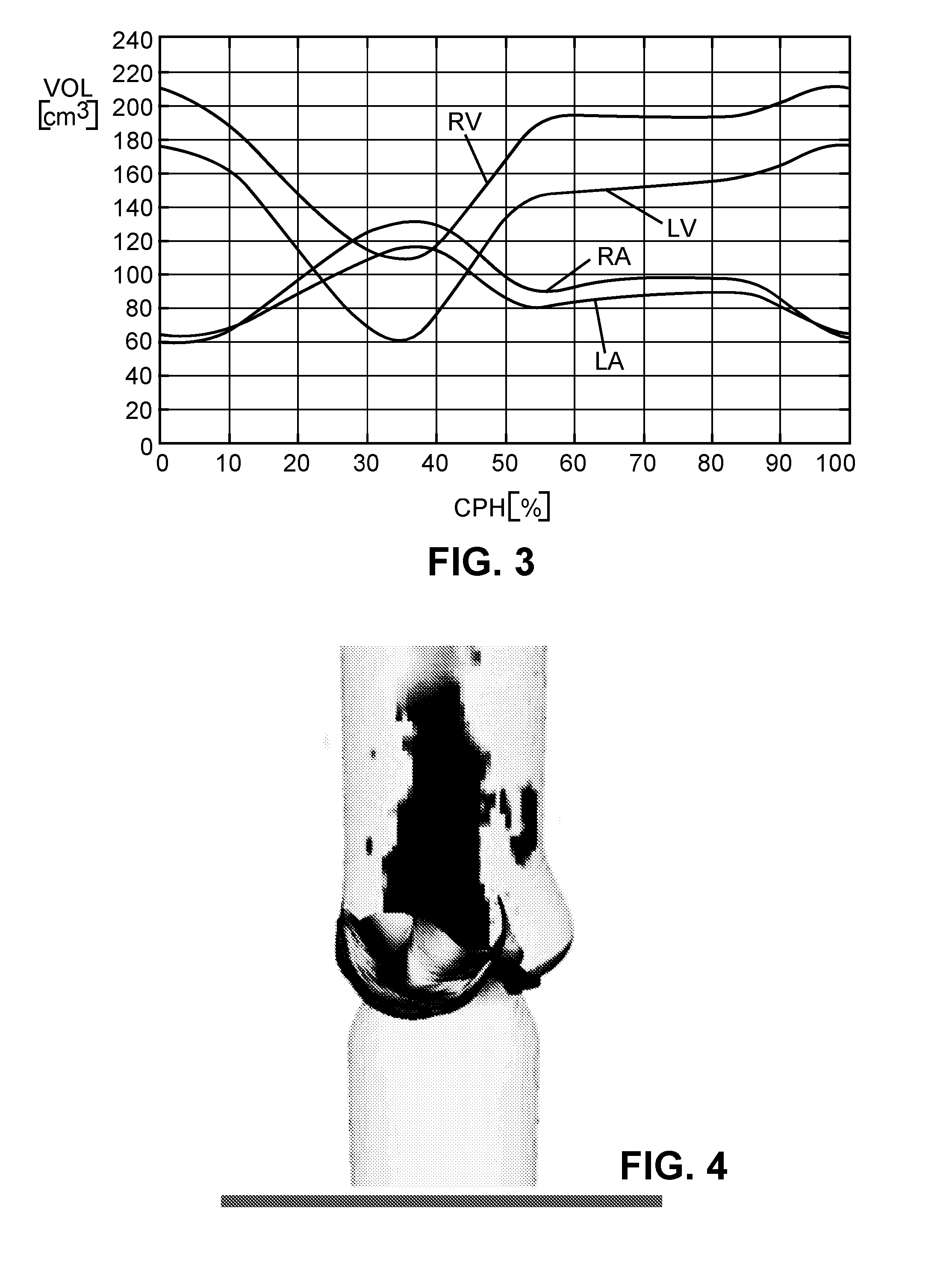 Method and apparatus for simulating blood flow under patient-specific boundary conditions derived from an estimated cardiac ejection output