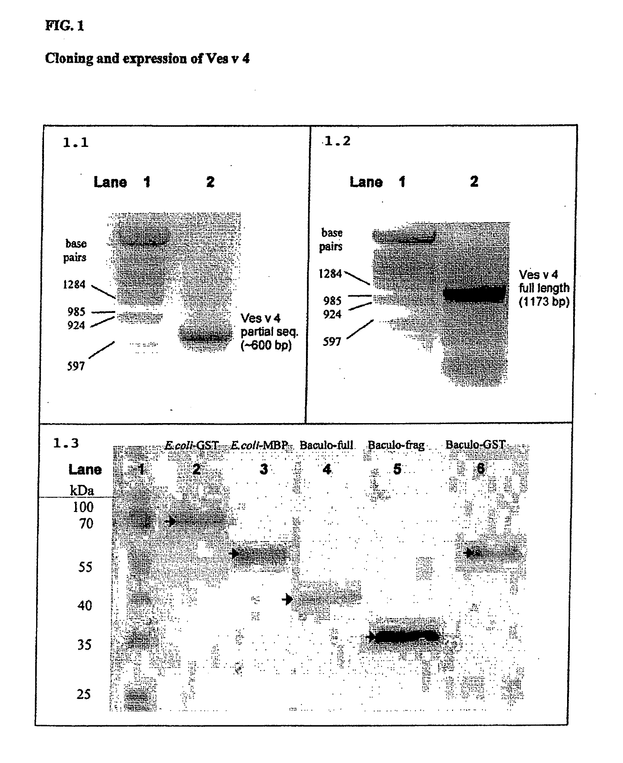 Cloning and recombinant productions of vespula venom protease and methods of use thereof