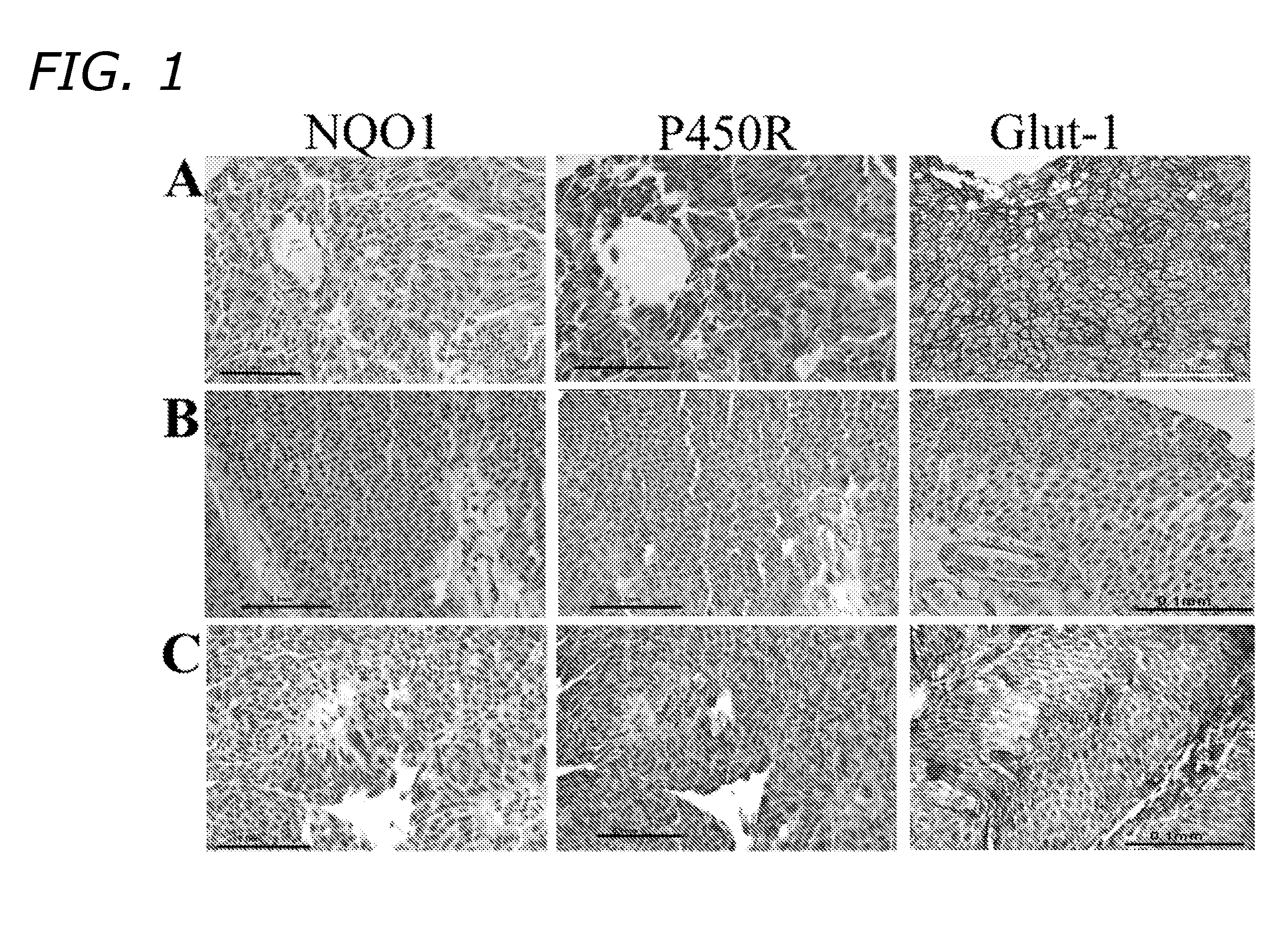 Bladder cancer treatment and methods