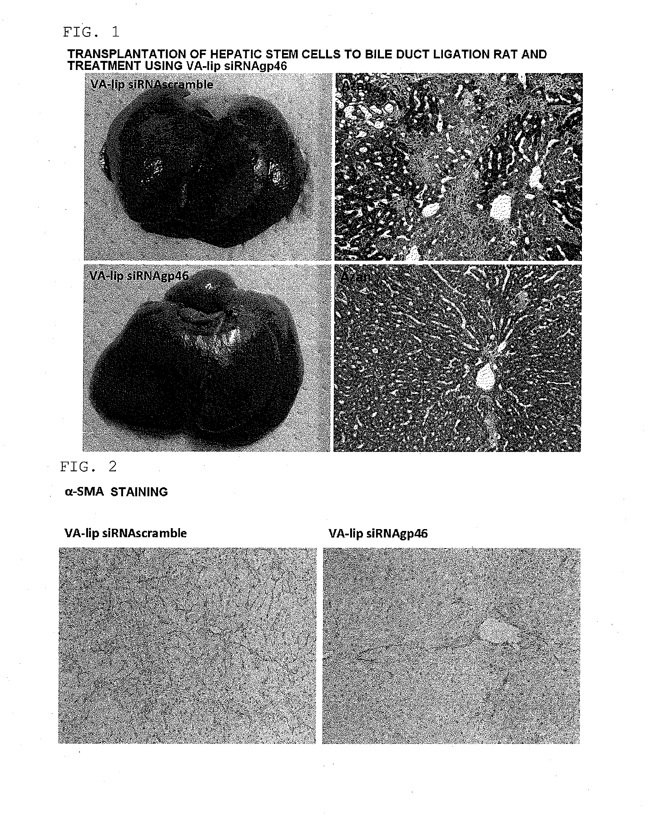 Composition for regenerating normal tissue from fibrotic tissue