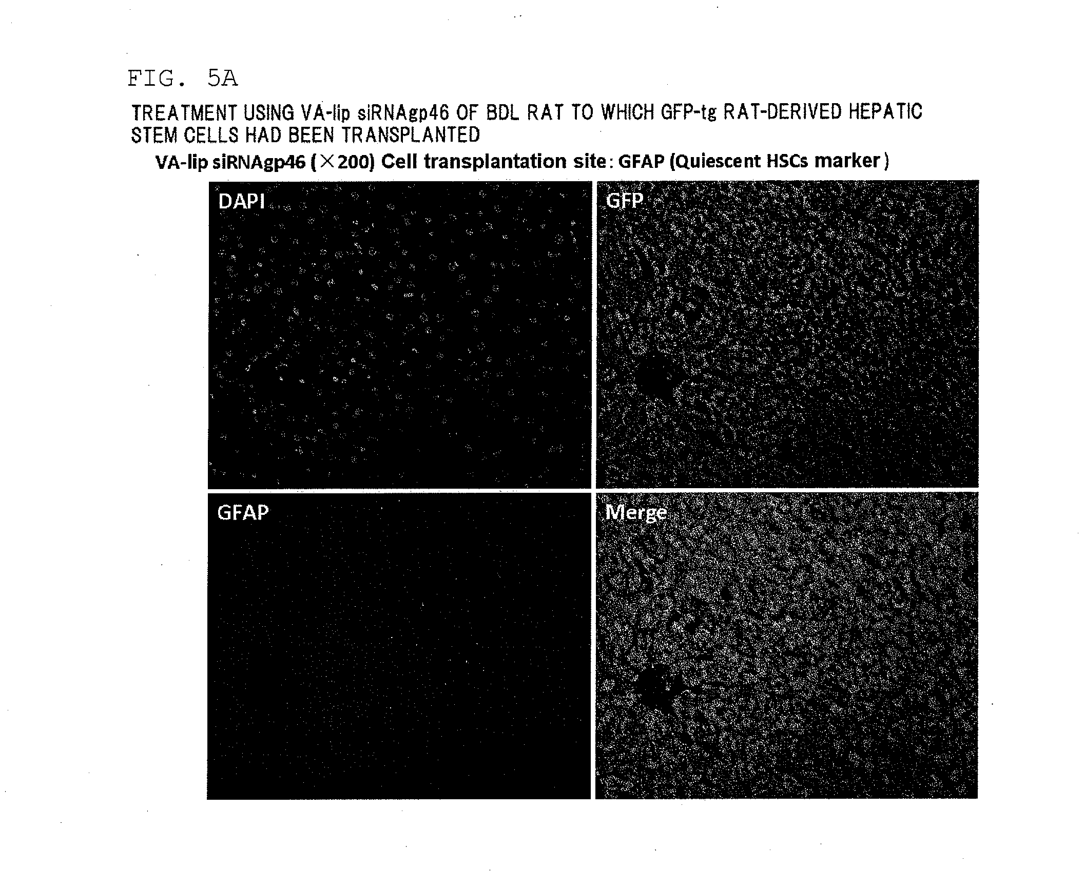Composition for regenerating normal tissue from fibrotic tissue