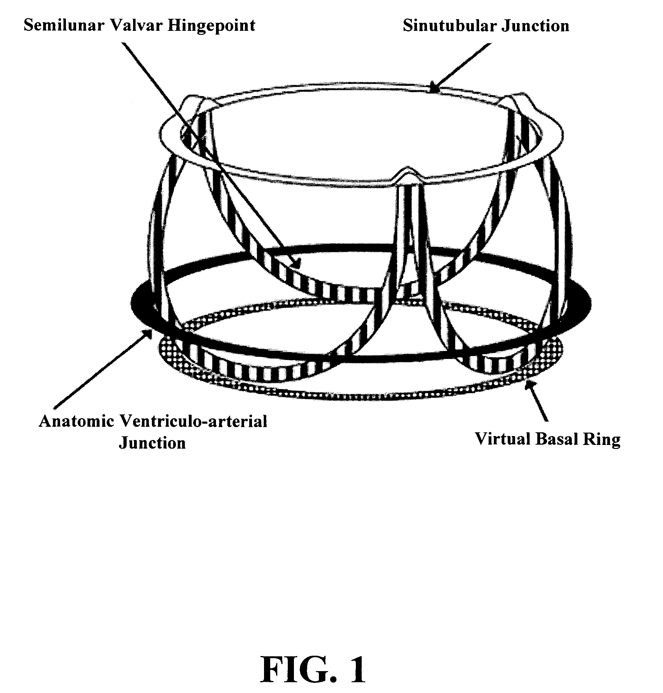 Cone-shaped aortic root replacement graft and methods for making and using same