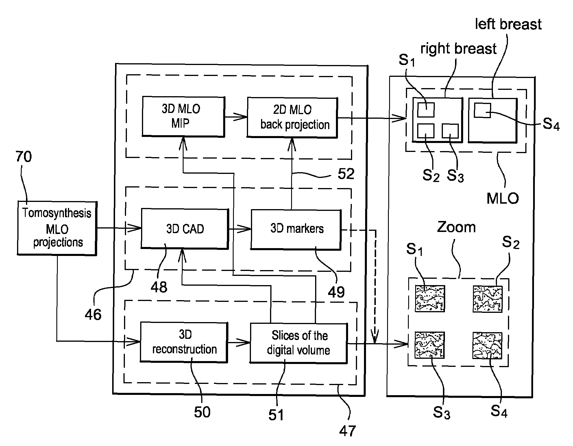 X-ray device and image-processing method