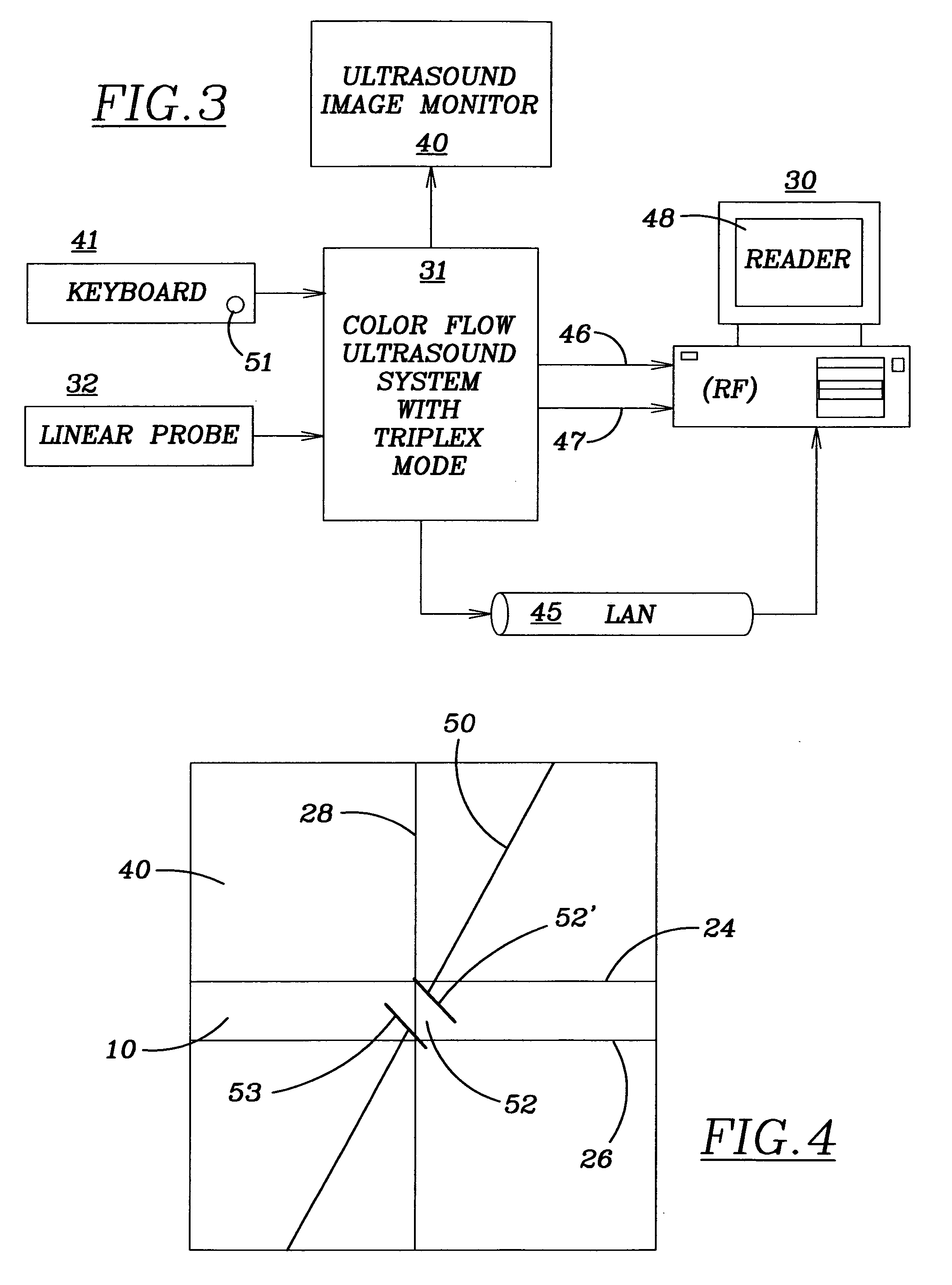 Method and diagnostic ultrasound apparatus for determining the condition of a person's artery or arteries