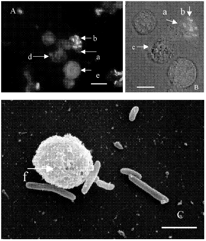 Method for identifying function and capability of cells for phagocytizing exogenous foreign bodies