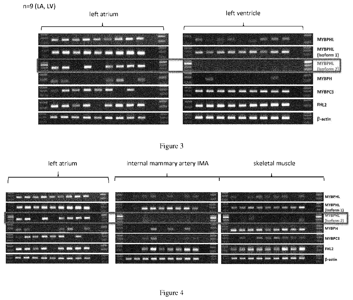 Method of diagnosing heart muscle damage