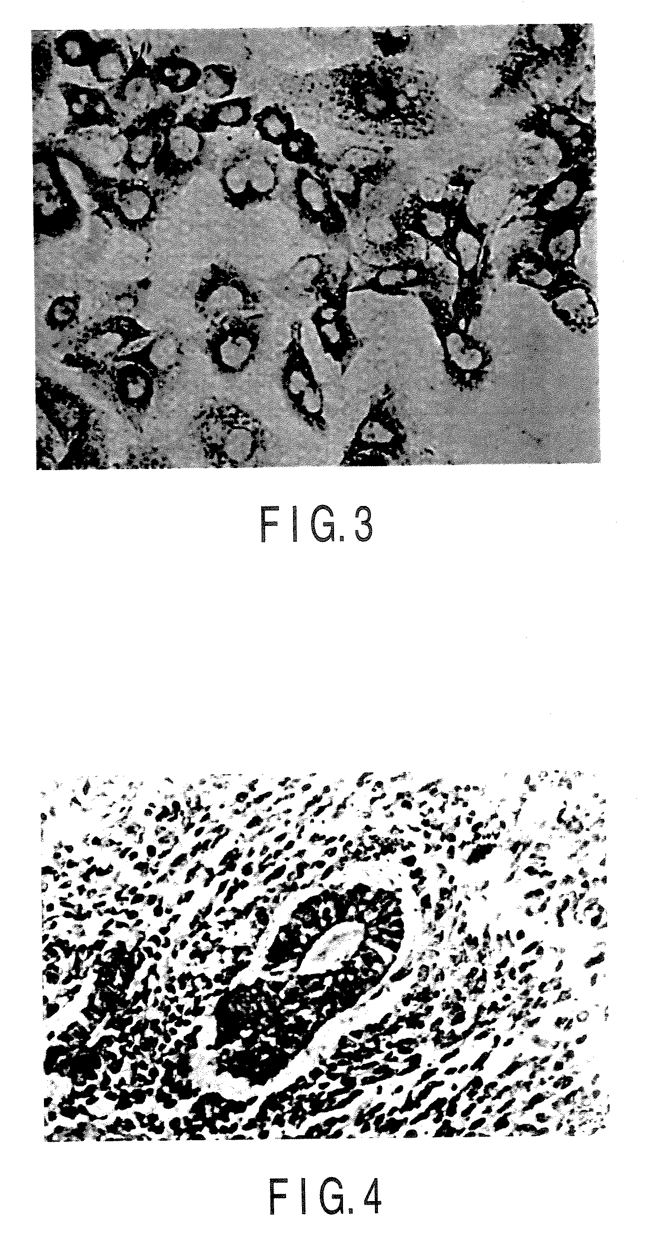 Monoclonal antibody specific to truncated midkine (TMK) protein and uses thereof