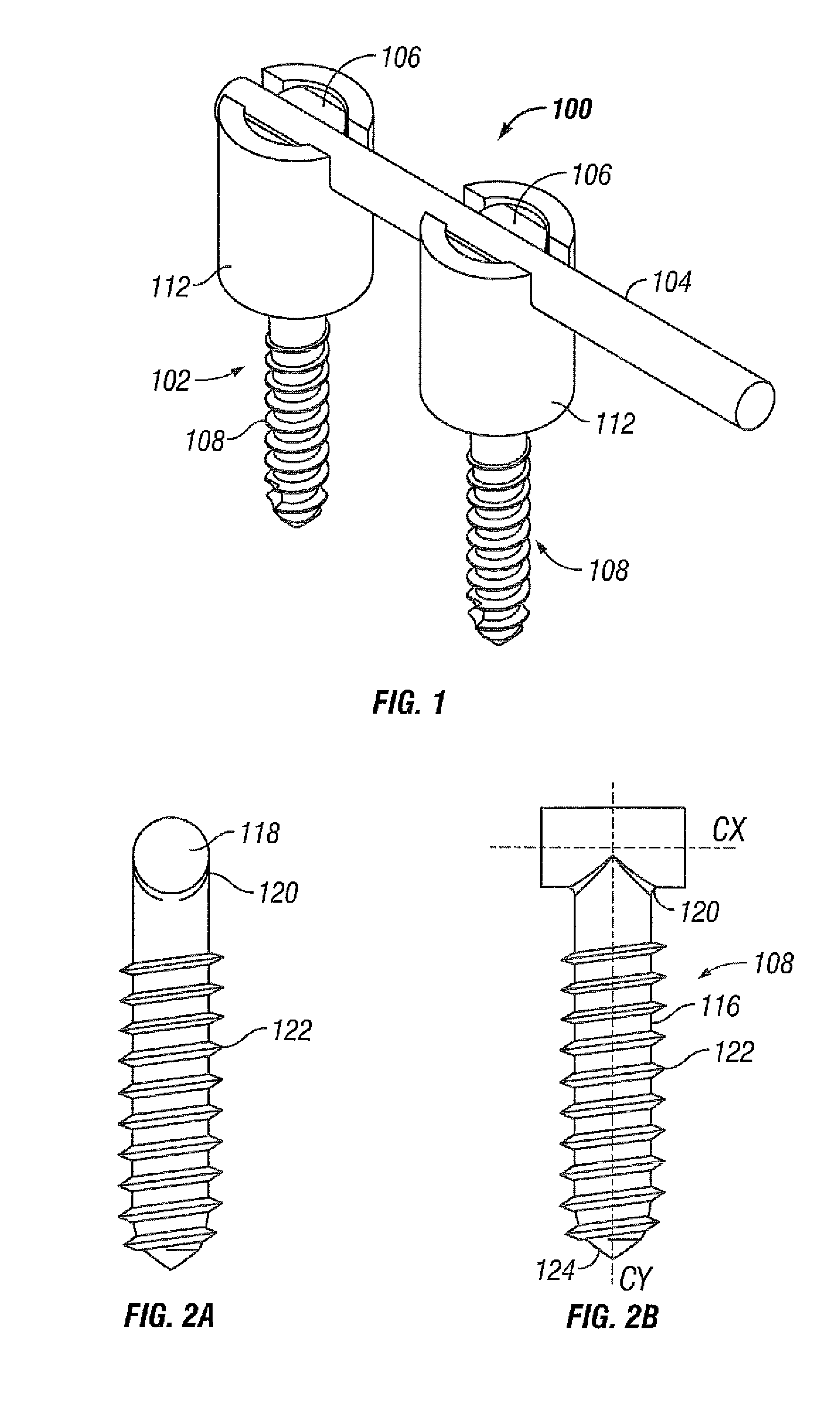 System and method for spine stabilization using resilient inserts
