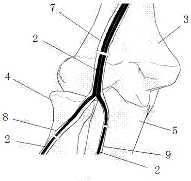 Fabrication method for skeleton and soft tissue X-ray developing image