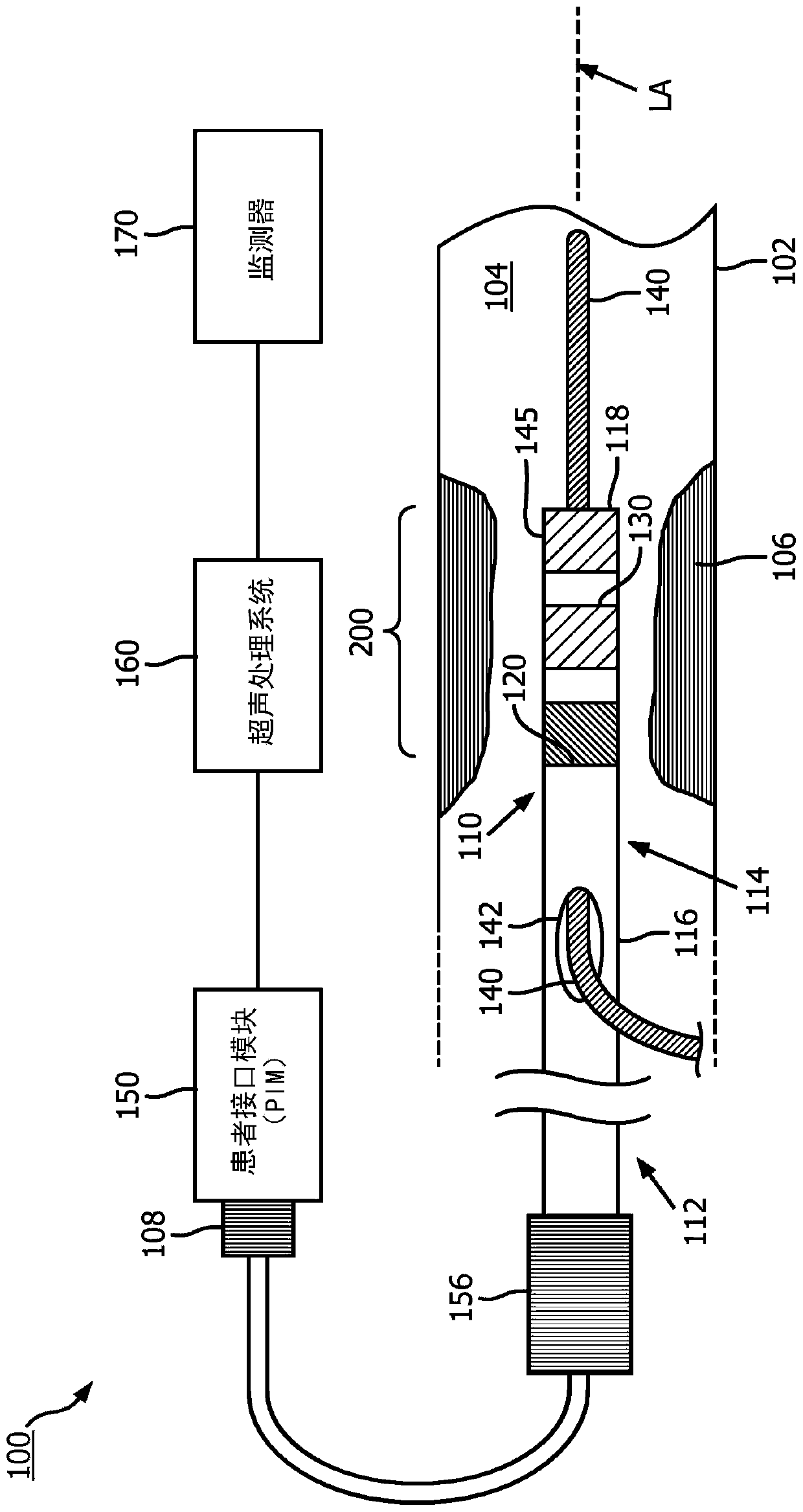 Frequency-tunable intraluminal ultrasound device