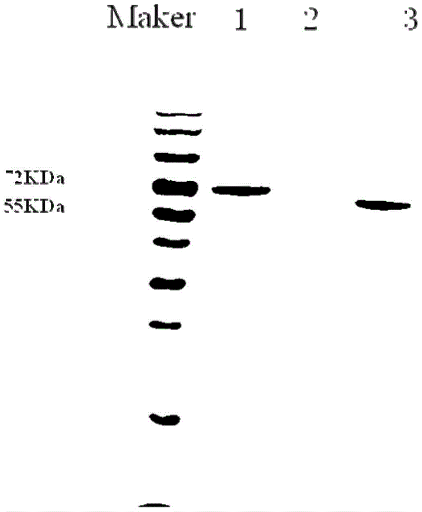 A kind of acid β-mannanase and its gene and application