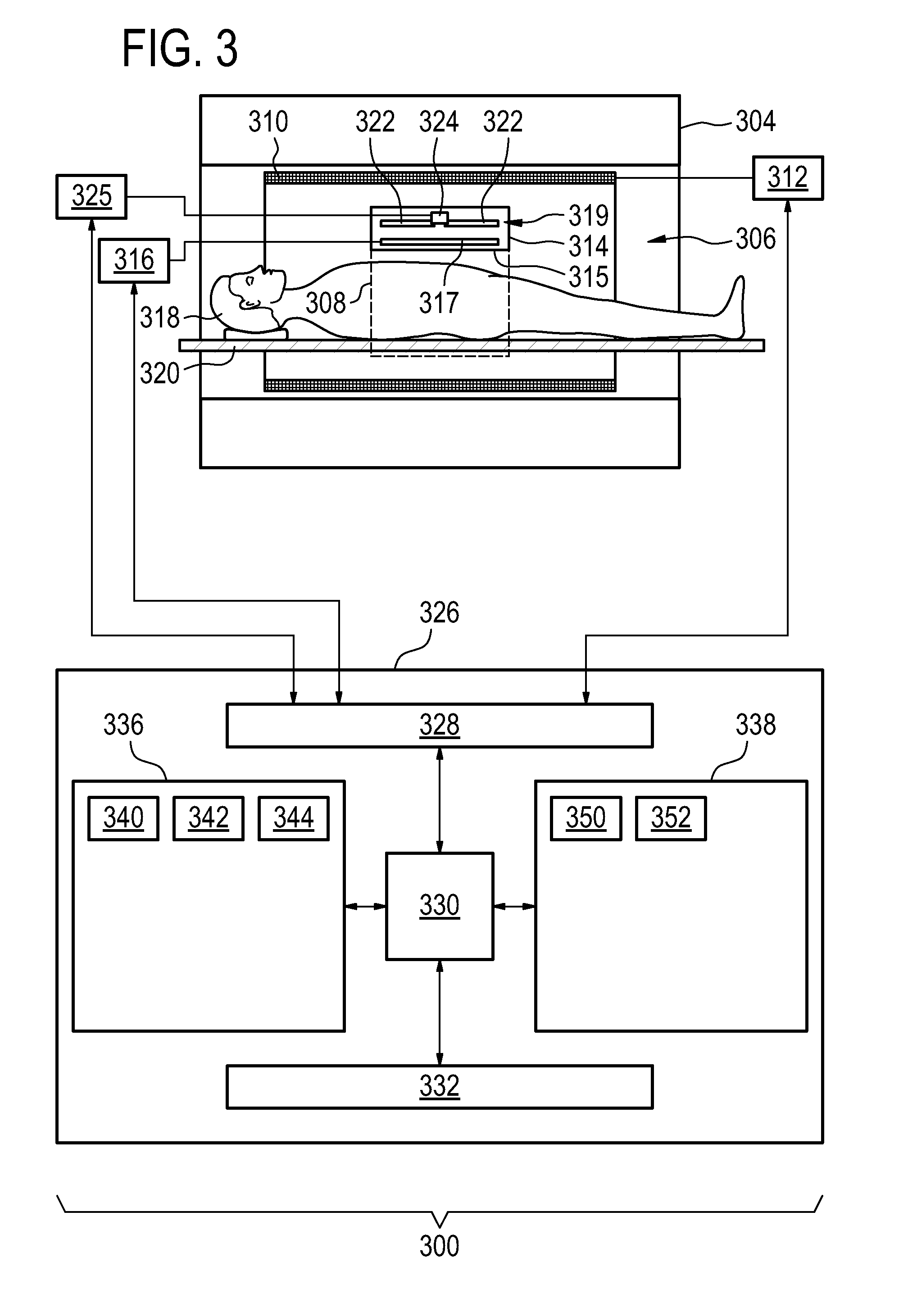 MRI coil assembly with a radio frequency shield switchable between a blocking state and a transparent state