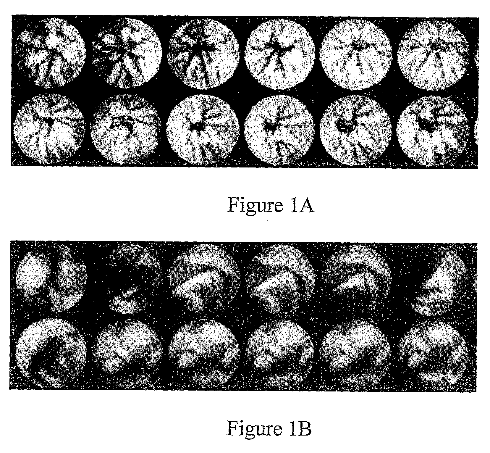 Device, system and method for automatic detection of contractile activity in an image frame