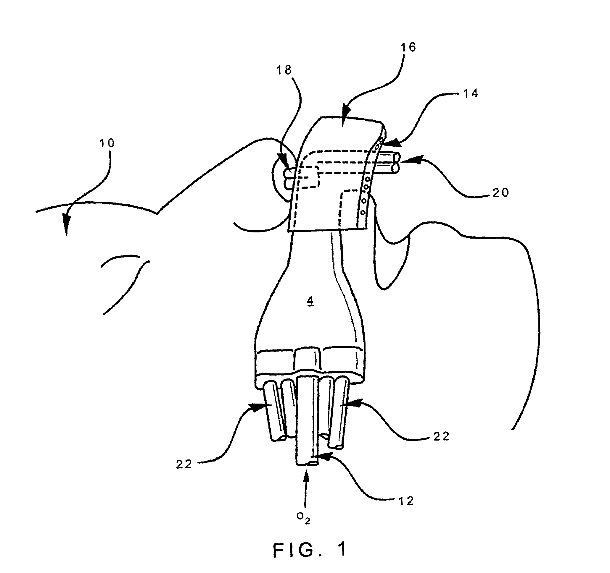 Apparatus and method for mask free delivery of an inspired gas mixture and gas sampling