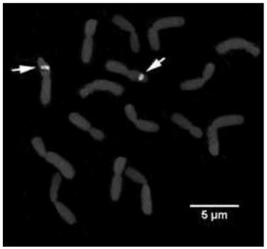 FISH (fluorescence in situ hybridization) method of allium mongolicum regel chromosome