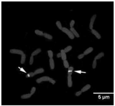 FISH (fluorescence in situ hybridization) method of allium mongolicum regel chromosome