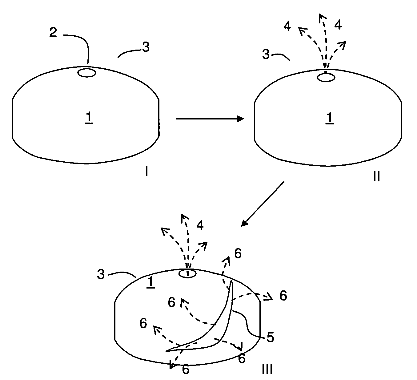 Rupturing controlled release device comprising a subcoat