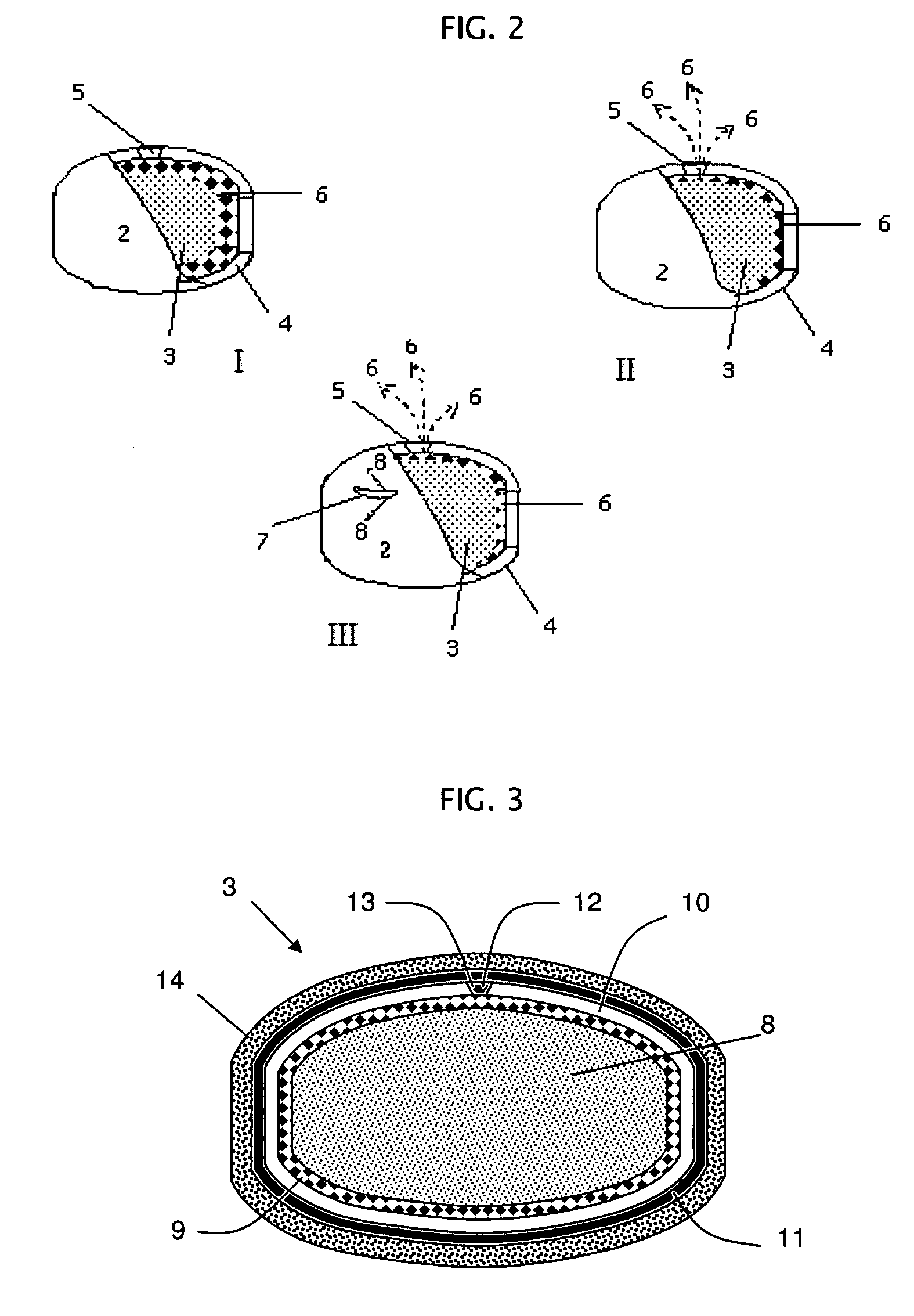 Rupturing controlled release device comprising a subcoat