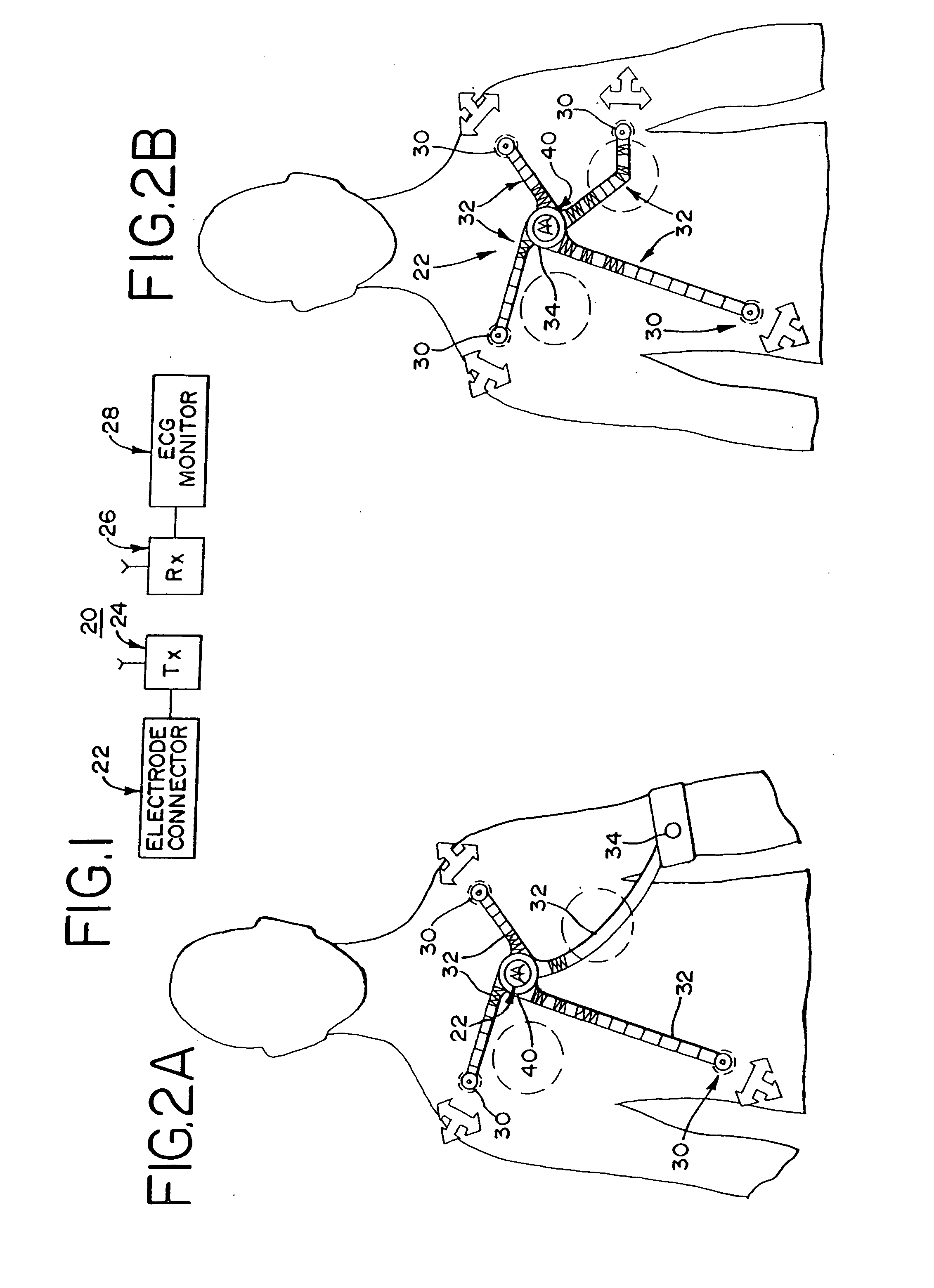 Wireless electrocardiograph system and method