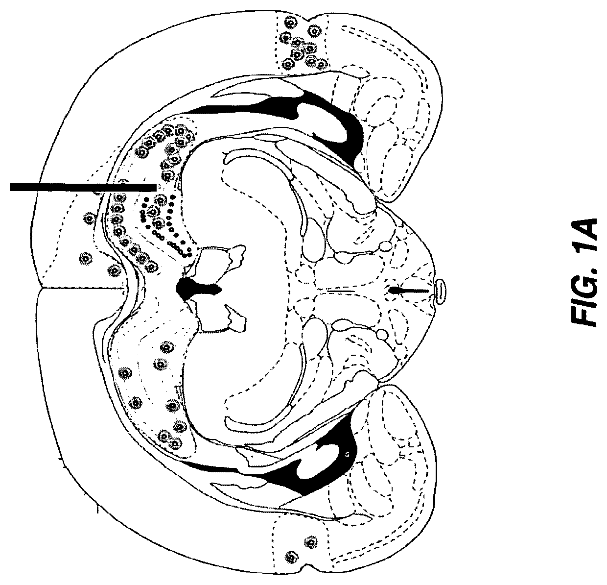 Gene therapy for neurometabolic disorders