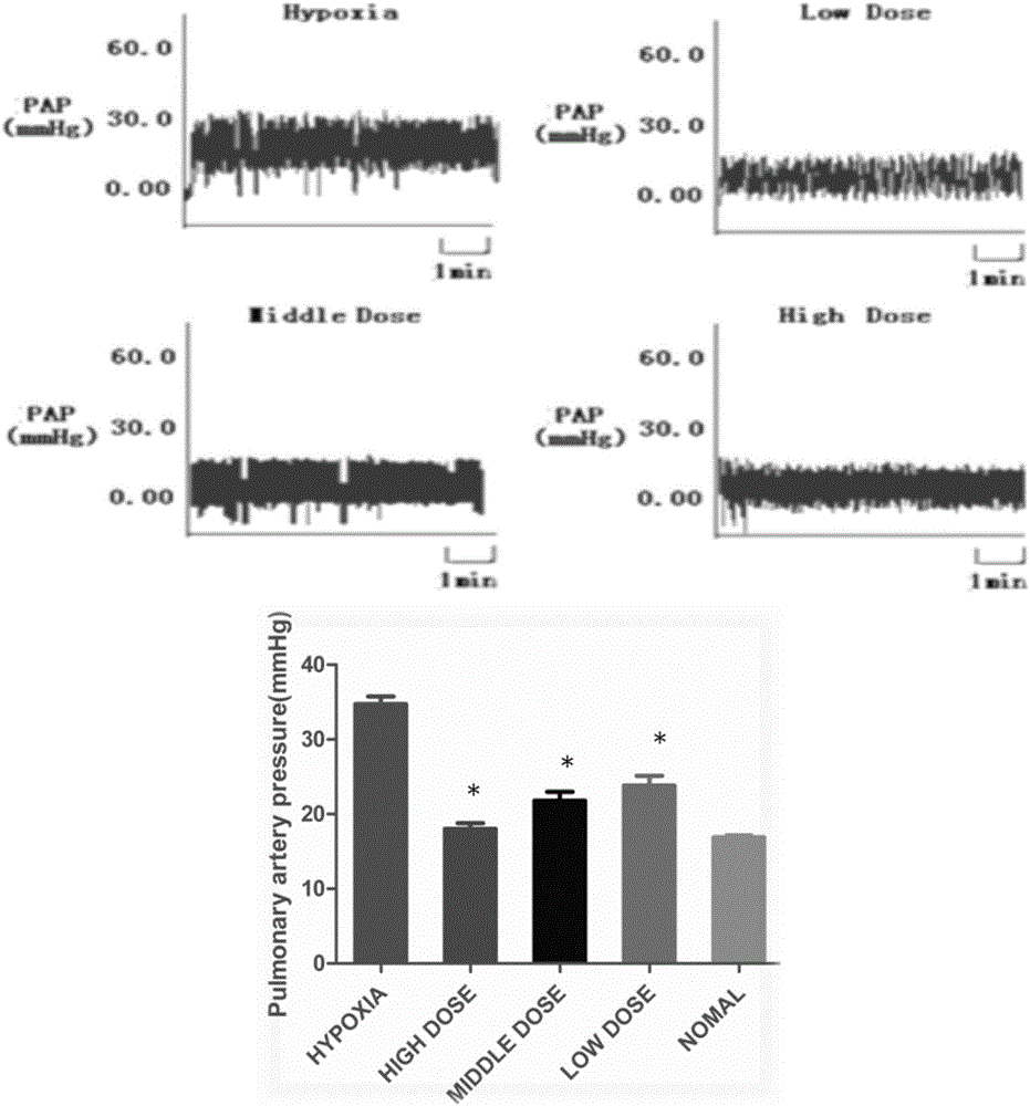 Preparation method and pharmaceutical application of effective part of rhodiola rosea