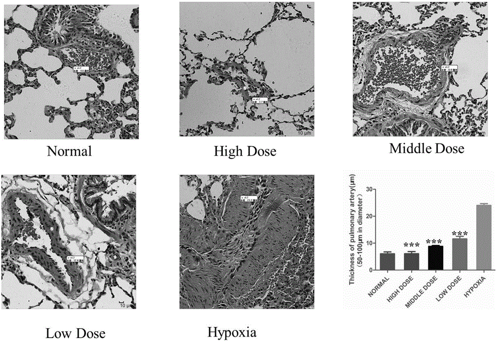 Preparation method and pharmaceutical application of effective part of rhodiola rosea