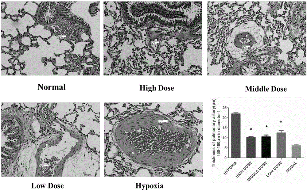 Preparation method and pharmaceutical application of effective part of rhodiola rosea