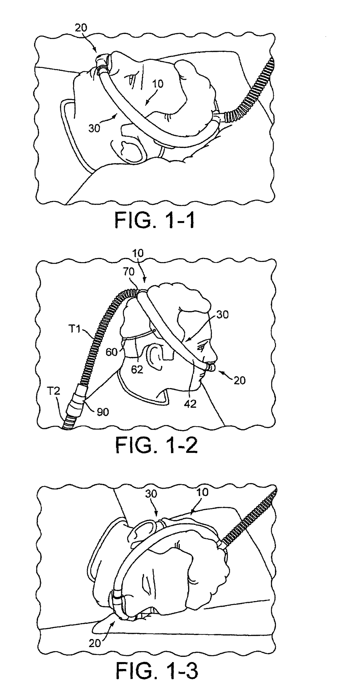 Delivery of respiratory therapy with nasal interface