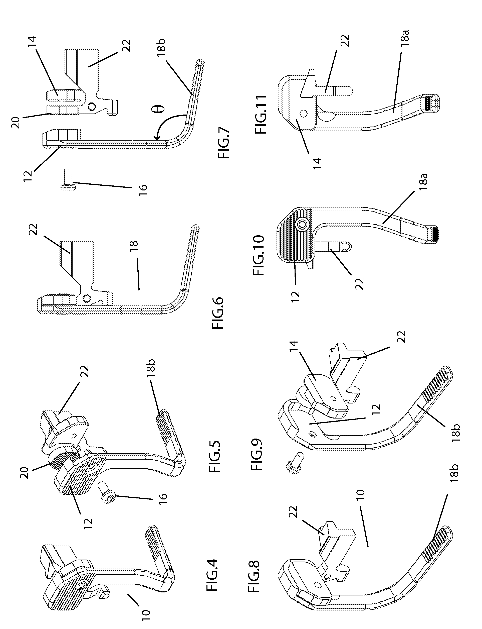 Battery assist device