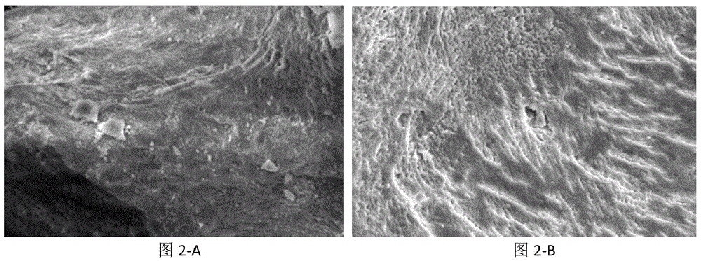 Antigen-removing biological bone and preparation method thereof