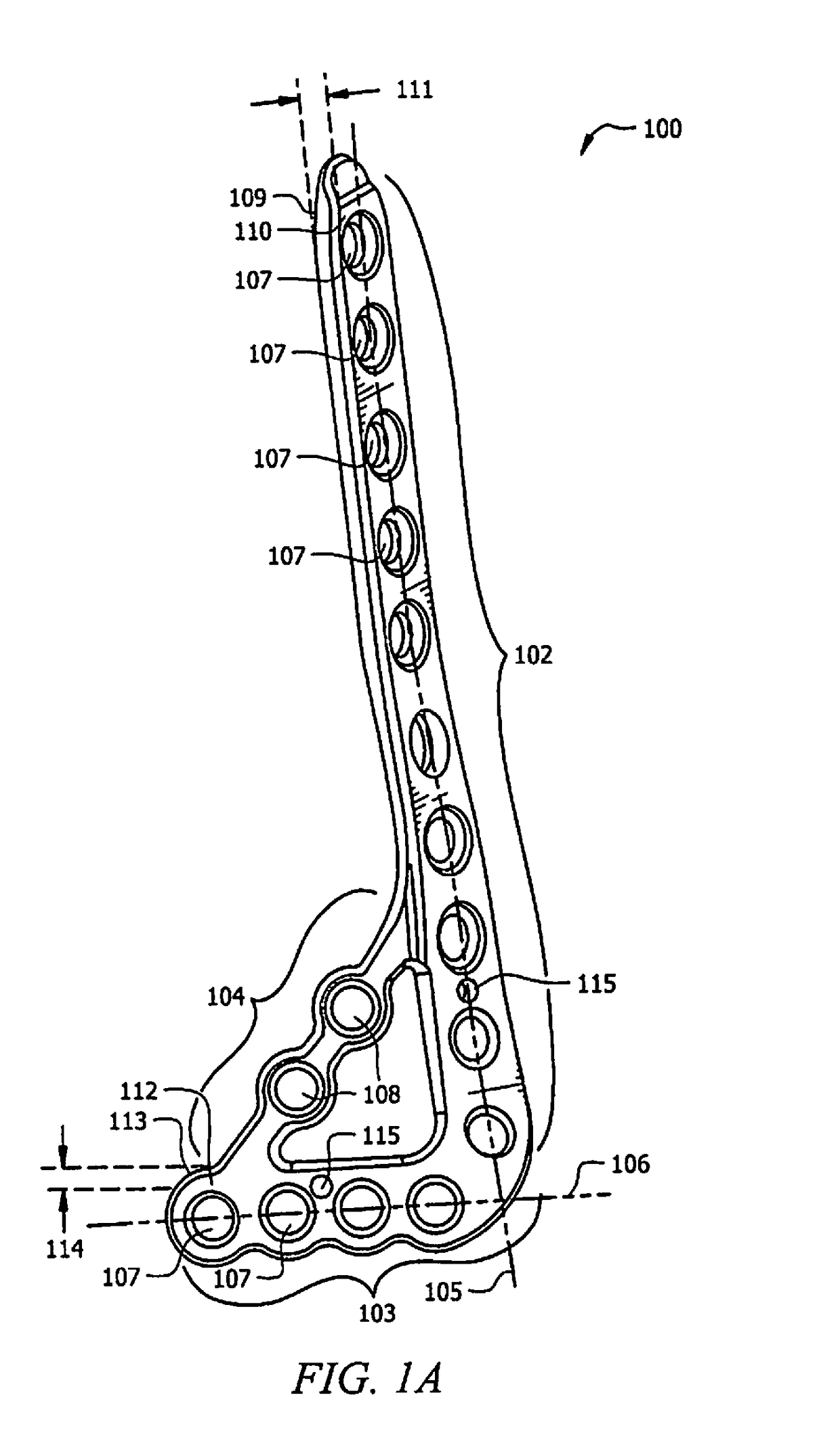 Ankle tibia plates