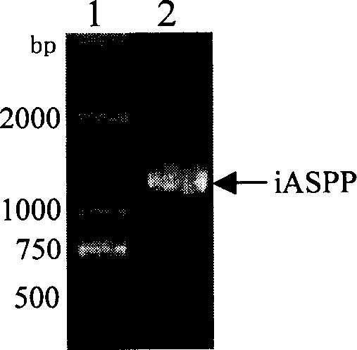 Mono-cloning antibody of anti-human cancer protein iASPP and use thereof
